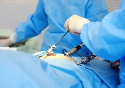 Diagnostic Laparoscopy in Noida | Dr. Mandavi Rai – Expert Gynecologist