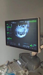 Expert Lapro & Gynecologist in Noida | Dr. Mandavi Rai