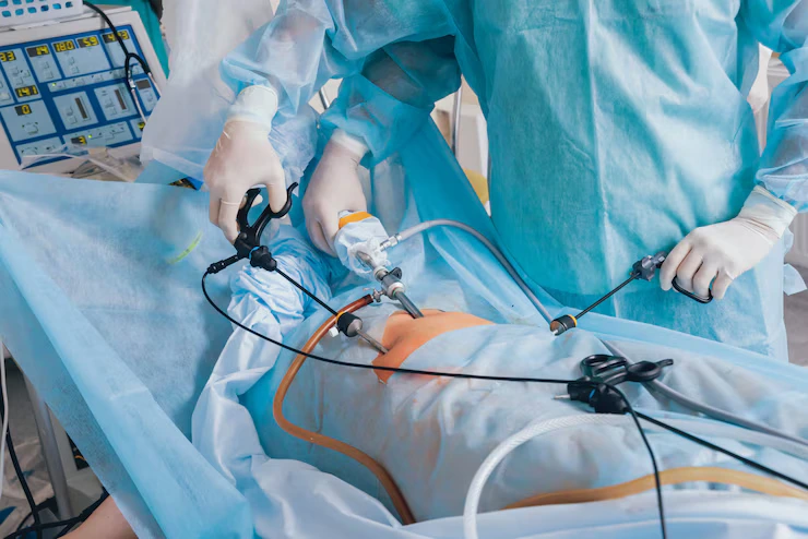 Laparoscopic Surgeon In Noida