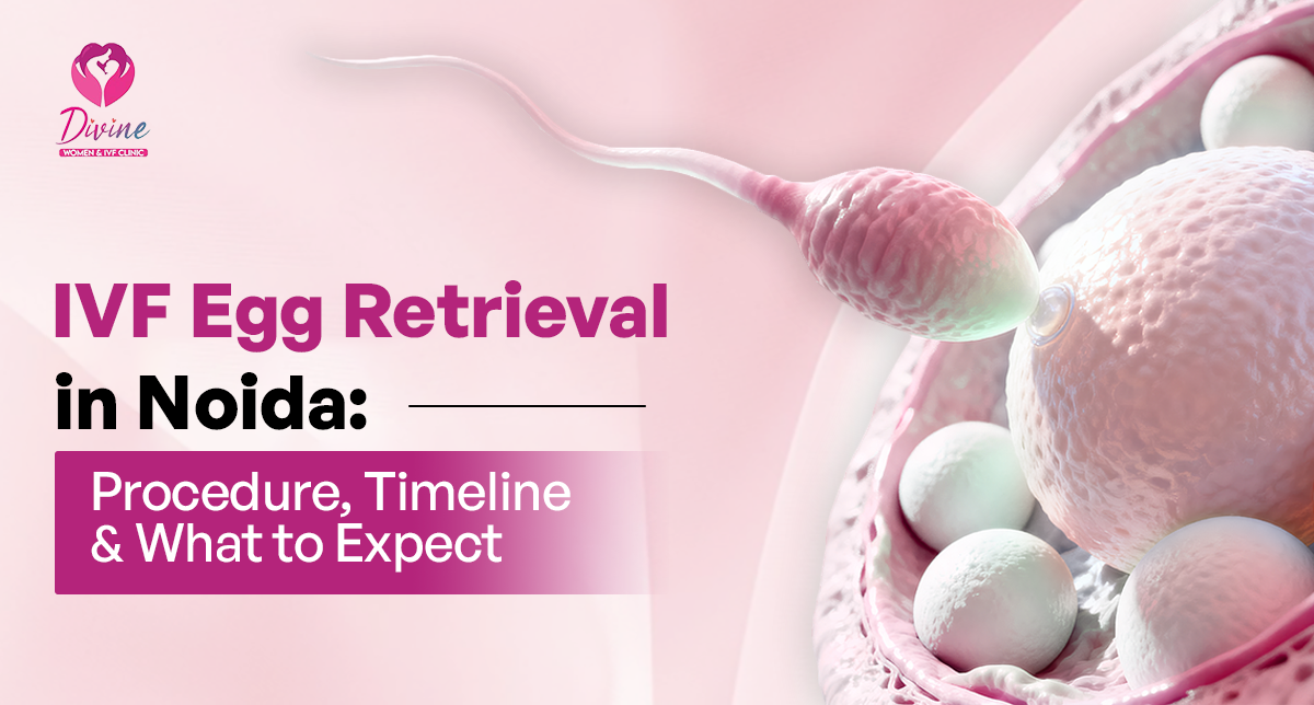 IVF Egg Retrieval in Noida