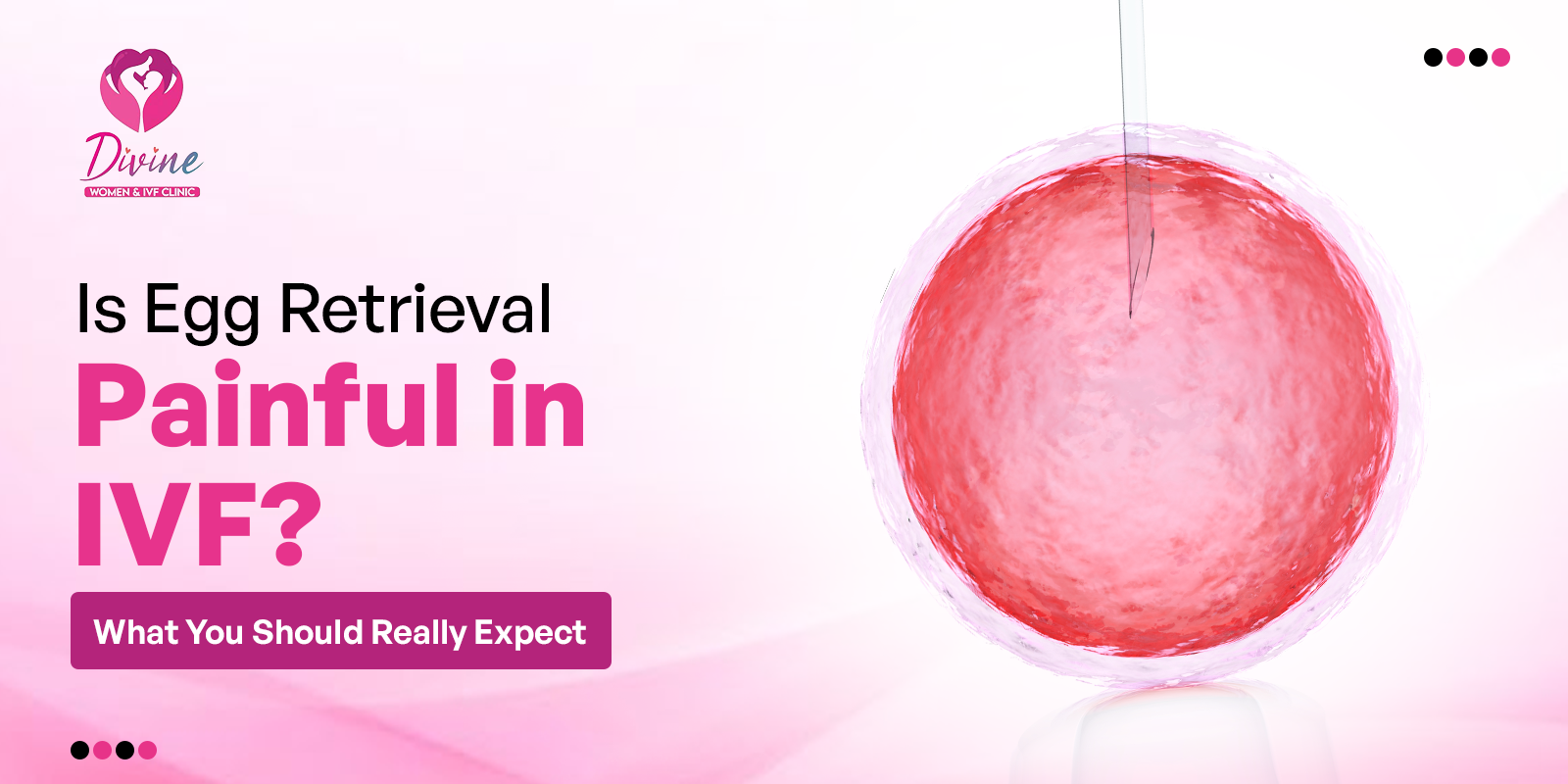 Is Egg Retrieval Painful in IVF- What You Should Really Expect