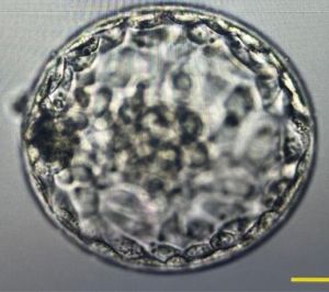 blastocyst-stage embryo under a microscope